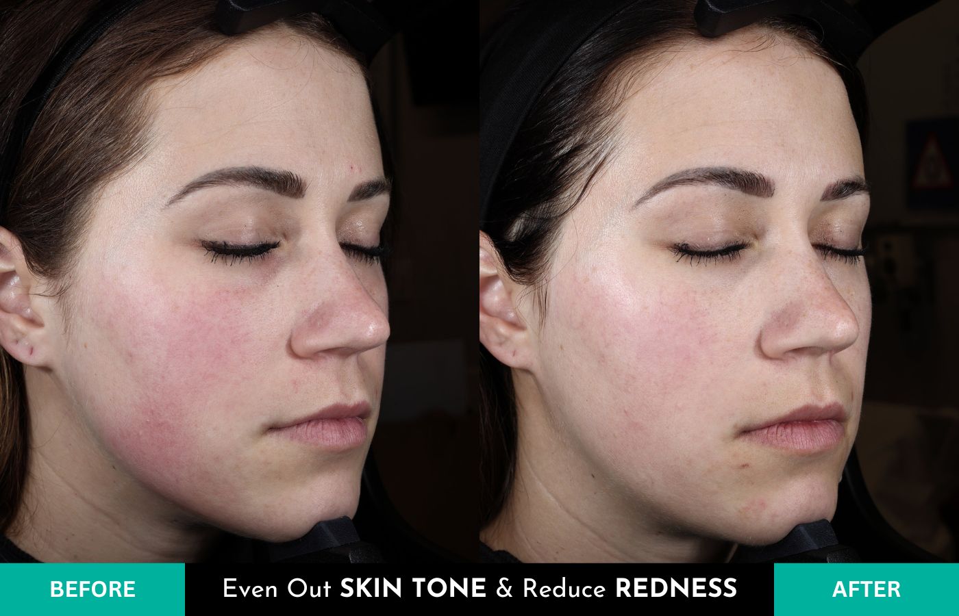 Before and After Plated Daily Exosome Serum