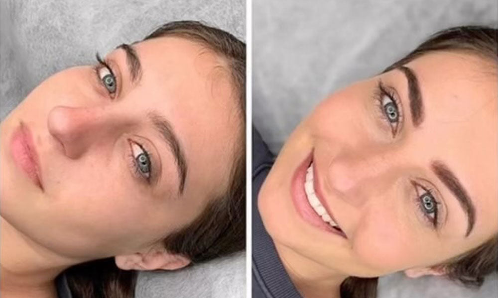 Before and after eyebrow micro-shading